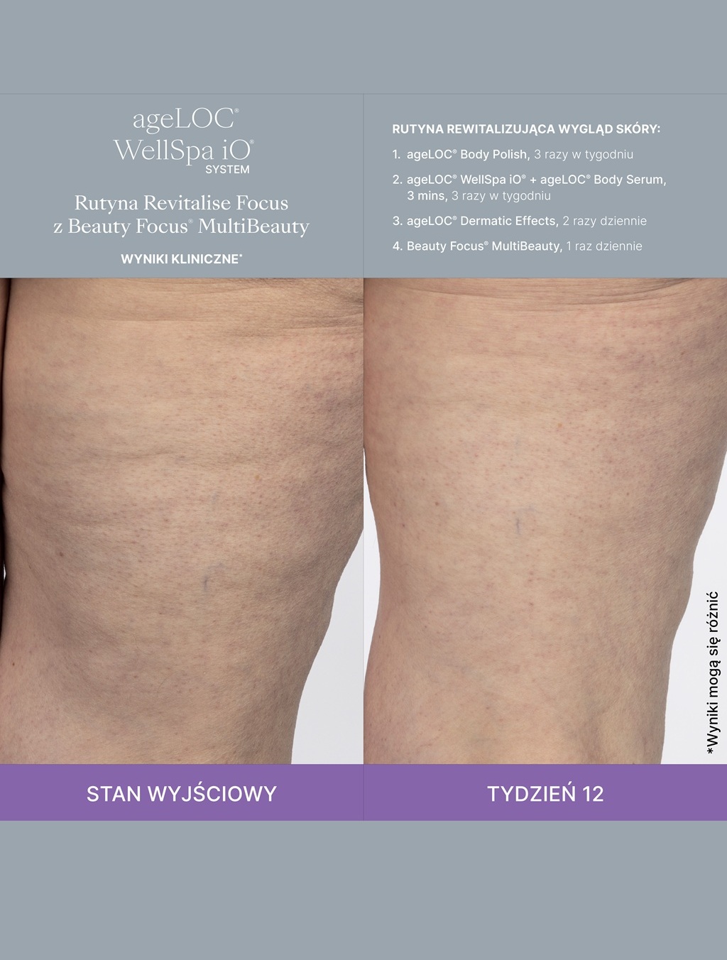 WellSpa iO-MultiBeauty-Before-After-Images
